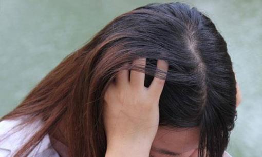 Có đúng là những người có mái tóc dày thường sống lâu hơn không? Tuổi thọ liên quan đến điều gì?