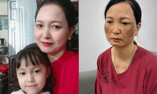 U40 chia sẻ bí quyết hết nám cho hàng trăm chị em