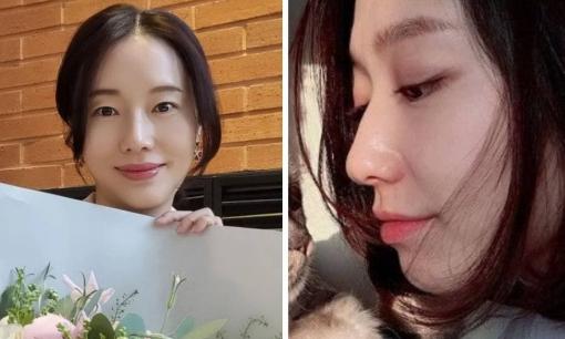 'Ảnh hậu' Lee Jung Hyun và Park Shin Hye: Hai bà bầu thi nhau gây sốt vì diện mạo quá xuất sắc