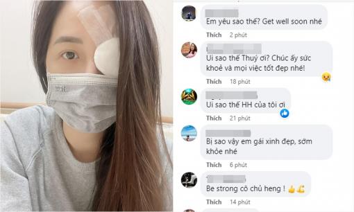 Hoa hậu Mai Phương Thúy đăng ảnh bị băng kín mắt, fans rần rần lo lắng