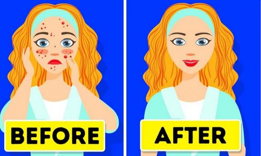 10 bước chăm sóc da kiểu Hàn Quốc để sở hữu làn da căng mướt đúng chuẩn, đẹp không lối thoát