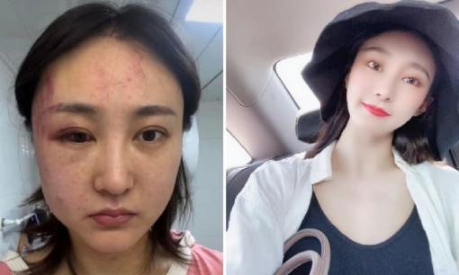 Sao 'Thần tài giá đáo' Từ Đại Bảo tố chồng kém tuổi bạo hành phải nhập viện nhiều lần