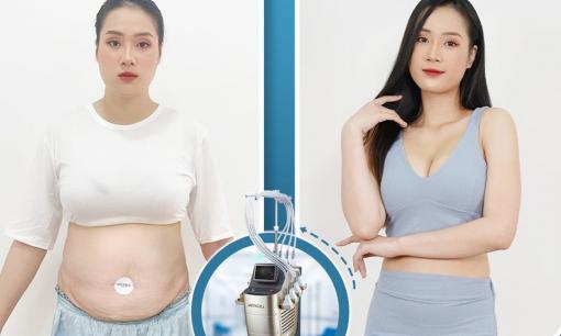 Meta Cell - Công nghệ giảm béo an toàn và hiệu quả bậc nhất 2022