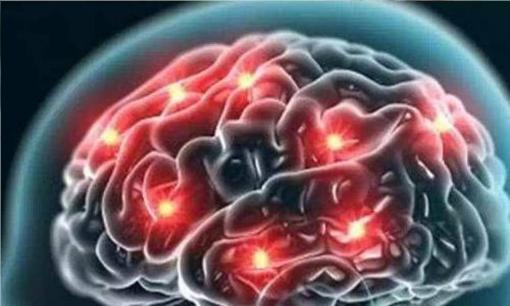 Không đủ máu cung cấp cho não, có thể có 3 'thay đổi tế nhị' này mà hầu hết mọi người đều bỏ qua