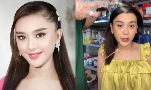 Lâm Khánh Chi khoe nhan sắc tươi tắn và xinh đẹp sau khi lộ vùng da cổ nhăn nheo, sần sùi