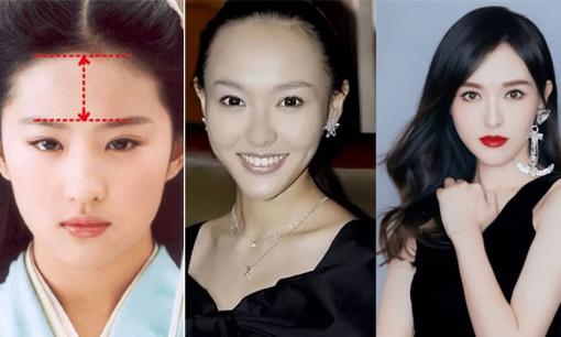 Làm thế nào để đường chân tóc không ảnh hưởng đến ngoại hình? Đọc xong bạn sẽ biết! 