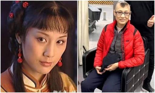 Nổi tiếng vì một nốt ruồi, bà sống với đạo diễn 27 năm mà không có danh phận, tuổi 63 tuổi bị hói đầu vì mắc bệnh ung thư