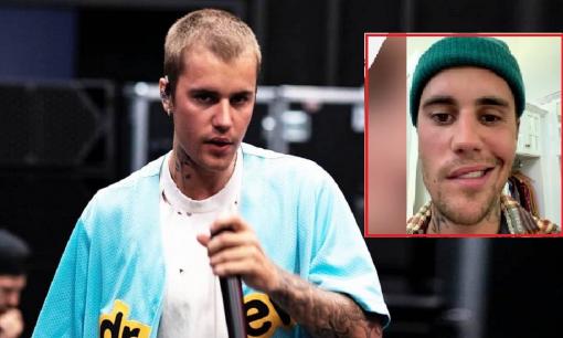 Justin Bieber chia sẻ thông tin sức khỏe hiện tại sau khi khuôn mặt bị liệt một nửa