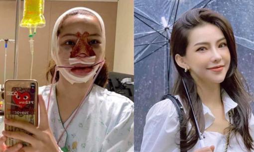 Lưu Đê Ly khoe thành quả trước và sau thẩm mỹ, khẳng định chưa từng hối hận vì 'dao kéo'