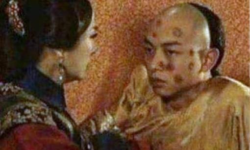 Cách đây 41 năm, bệnh đậu mùa đã được loài người loại trừ, căn bệnh giết chết hàng trăm triệu người này đã bị xóa sổ như thế nào?