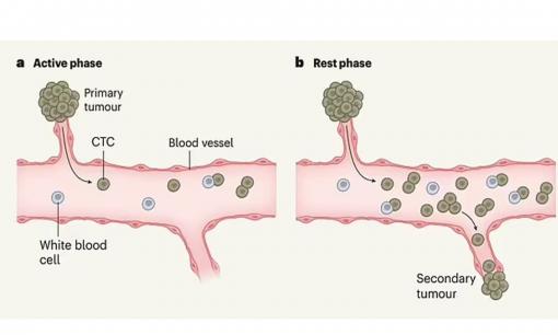 Ung thư 'phát triển tốt nhất khi bạn NGỦ': Các nhà khoa học cảnh báo các khối u 'thức giấc' trong đêm