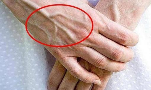 Một số người có gân xanh nổi lên trên tay, một số thì không! Vậy người nào thể hiện sức khỏe tốt hơn? 