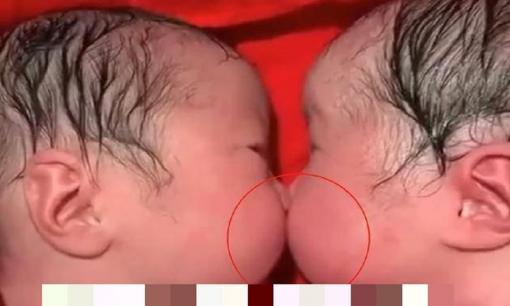Cặp anh em song sinh 'hôn' nhau từ khi mới lọt lòng, y tá không nỡ bế đi. Cư dân mạng: 'Tình nhân kiếp trước!'