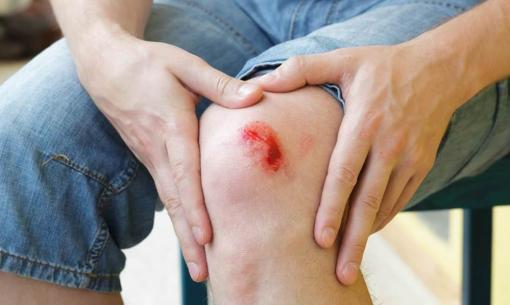 5 con giáp nửa cuối năm đề phòng tai nạn, rắn rết cắn, đề phòng xe cộ, đề phòng mất trộm