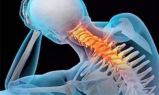 Các triệu chứng của bệnh thoái hóa đốt sống cổ là gì? Làm thế nào để phòng tránh bệnh thoái hóa đốt sống cổ? 