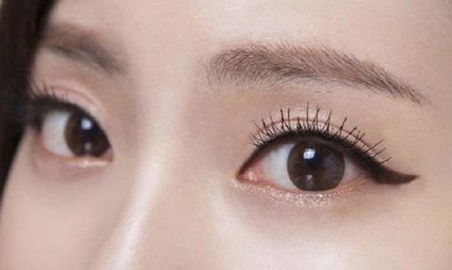 Phun mí mắt mở tròng - 3 nguyên nhân gây đau thường gặp