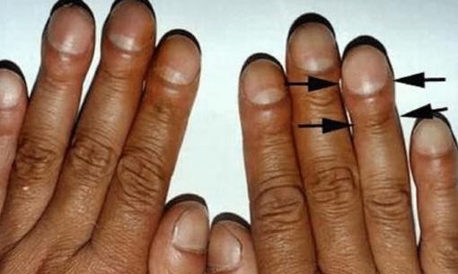 Cách chẩn đoán các bệnh nội tạng, đặc biệt là ung thư, từ các triệu chứng thực thể