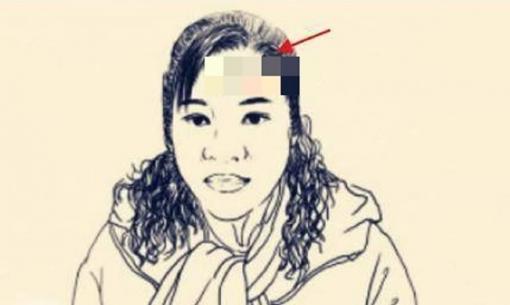 Trên mặt có 4 nốt ruồi tai họa, quý nhân cản trở, không tiết kiệm được tiền bạc, vất vả cả đời