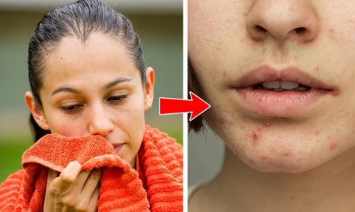 Mụn trứng cá xuất hiện trên 7 bộ phận cơ thể này đang cố gắng nói cho bạn biết sai lầm gì về lối sống?