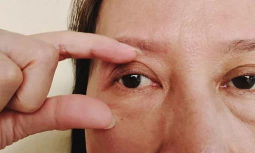 Mắt bị giật là dấu hiệu cảnh báo một căn bệnh nguy hiểm, bạn đừng bỏ qua! 