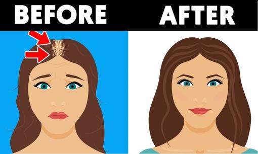 8 cách tự nhiên tại nhà giúp tóc dày và phồng hơn gấp nhiều lần, khỏe từ trong ra ngoài