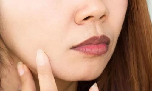 Cách khắc phục môi thâm đánh son không đẹp có ở đây, chị em sẽ tiếc vì không biết sớm hơn