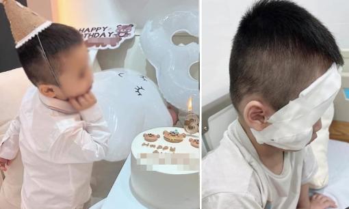 Trang hoàng sinh nhật thật đẹp, người mẹ không ngờ bóng bay đụng lửa, nổ tung tóe làm bỏng mặt con