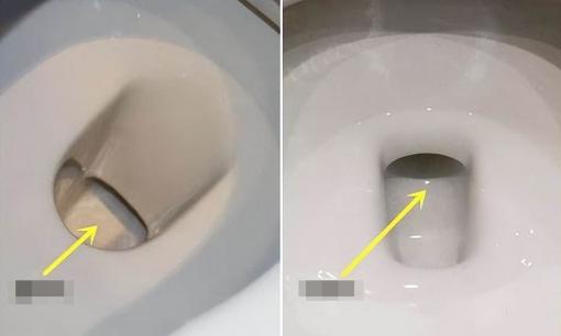 Nên mua bồn cầu xả hay hút? Gia đình tôi đã lựa chọn sai lầm ngay từ đầu, nên khi sử dụng rất “khổ”