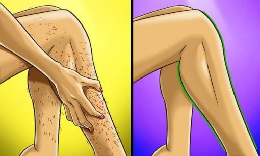 Tại sao tẩy lông chân sẽ tốt hơn cạo? Lời giải đáp từ chuyên gia