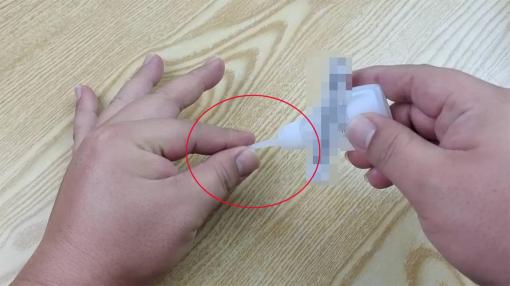 Tôi phải làm gì nếu tay bị dính keo 502? Đừng lo lắng, chỉ cần nhỏ một chút, keo sẽ tan chảy ngay lập tức mà không bị đau