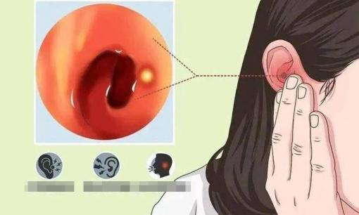 Nếu thường xuyên bị ngứa tai, hoặc biểu hiện của 4 bệnh, bác sĩ: Khuyến cáo mọi người nên để ý các bệnh sau