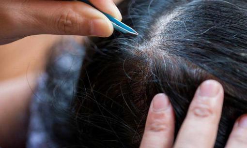 3 lý do tại sao không nên nhổ tóc bạc?