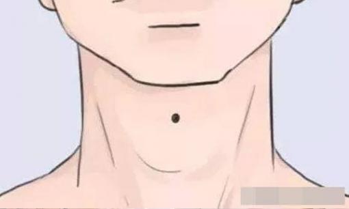 Bốn nốt ruồi phú quý, chỉ chiếm một nốt ruồi thôi là bạn đã đủ giàu rồi!