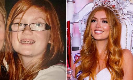 Cô sinh viên hàng không vũ trụ bị trêu chọc ở trường vì ngoại hình đã trở thành nữ hoàng sắc đẹp của nước Anh