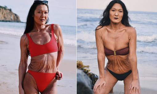 Sara Geurts - người mẫu 31 tuổi mắc chứng da nhăn hiếm gặp và hành trình chấp nhận 'điểm yếu' để tỏa sáng