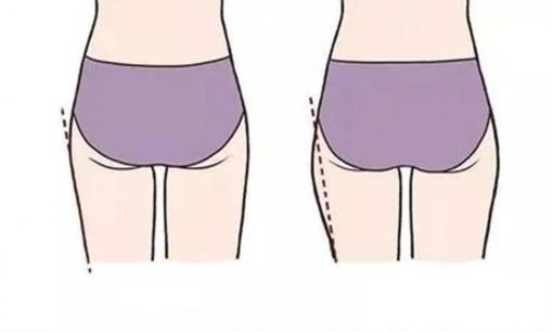 Đâu là sự khác biệt giữa người 'mông to' và người 'mông nhỏ'? Ai khỏe mạnh hơn?