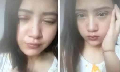 Tại sao không ủng hộ phụ nữ “cắt mắt 2 mí”. Chuyên gia nói “sự thật”