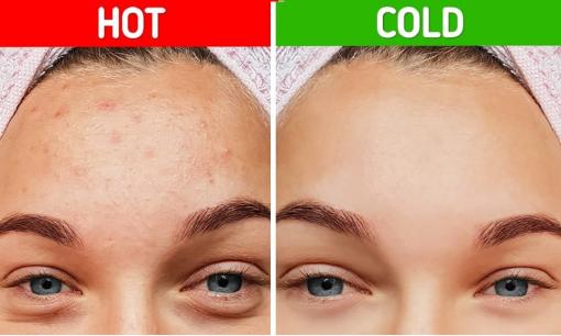 Nên rửa mặt bằng nước nóng hay nước lạnh vào mùa đông? 