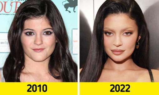 10 năm qua nhiều ngôi sao đã 'lột xác' về ngoại hình mà fans không nhận ra, khác nhất là nữ tỷ phú Kylie Jenner