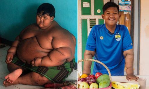 Cậu bé từng là đứa trẻ nặng nhất thế giới giờ ra sao?