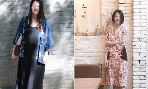 Chạy bộ cách ngày hay chạy bộ hàng ngày tốt hơn? Hãy nghe người giảm 15 cân trong 6 tháng nói gì