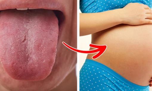 Có thai mà không biết? 6 dấu hiệu có thai bất ngờ có thể bạn chưa biết