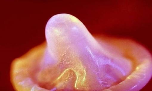 Nếu chồng áp dụng cách tránh thai này chứng tỏ anh ấy rất yêu vợ, liệu người đàn ông của bạn có chọn cách này không?