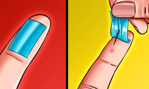 8 cách để lấy dằm ra khỏi da