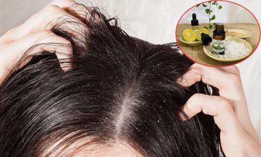 Tự làm dầu xả cho tóc bị khô, nhiều gàu, nấm cực đơn giản với các nguyên liệu có sẵn trong nhà