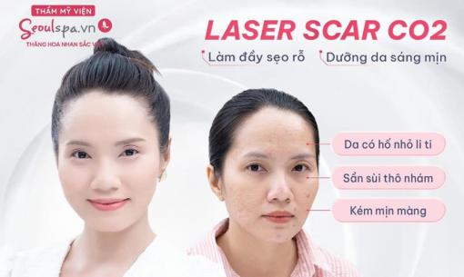 Điều trị sẹo rỗ, sẹo lõm hiệu quả tại Thẩm mỹ viện SeoulSpa.Vn