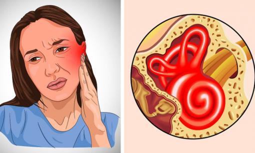 6 dấu hiệu bạn bị nhiễm trùng tai và cách phòng ngừa