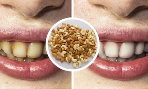 6 cách tẩy trắng răng an toàn