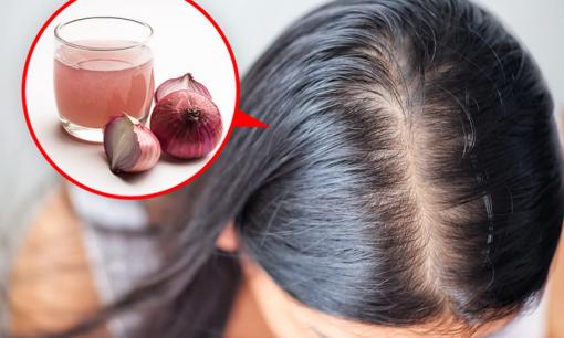 7 biện pháp khắc phục và cải thiện tình trạng rụng tóc của bạn một cách tự nhiên