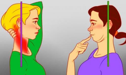 7 cách nhanh chóng để thoát khỏi cơn đau cổ